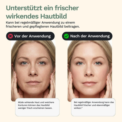 Rolandus G1 - Dispositivo per massaggio facciale